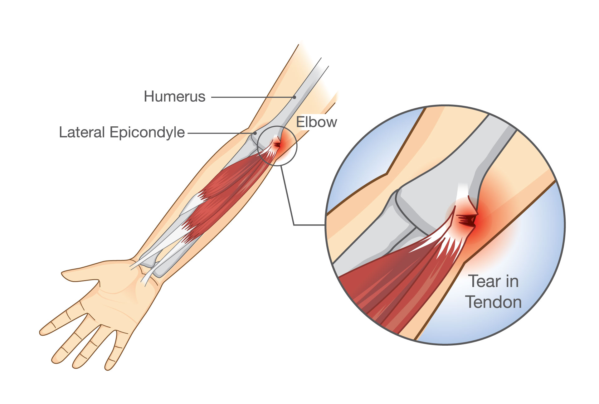 Elbow Anatomy