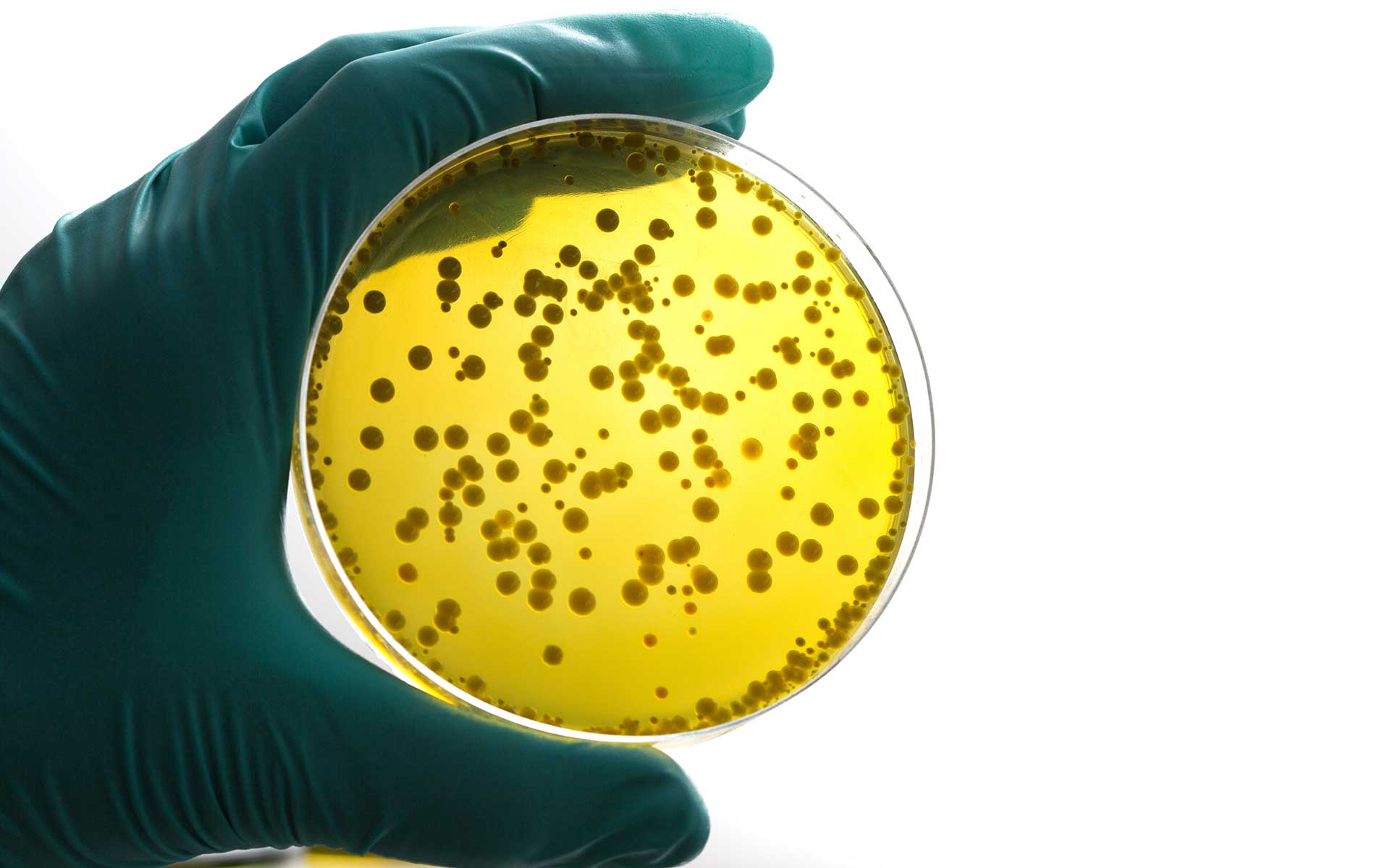 Желтые бактерии
